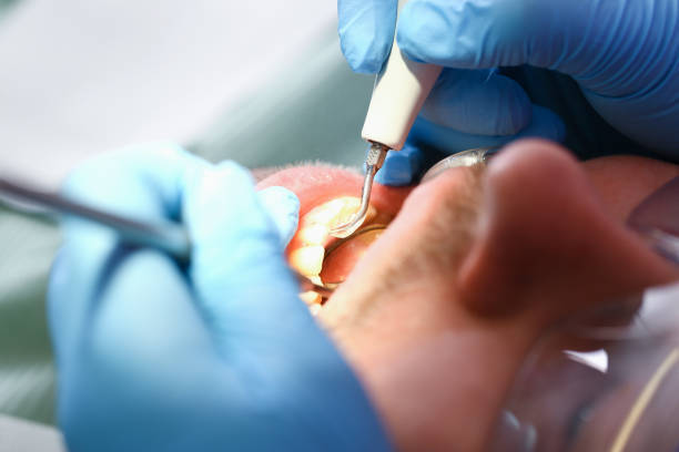 Best Emergency Gum Treatment in Cedville, AR