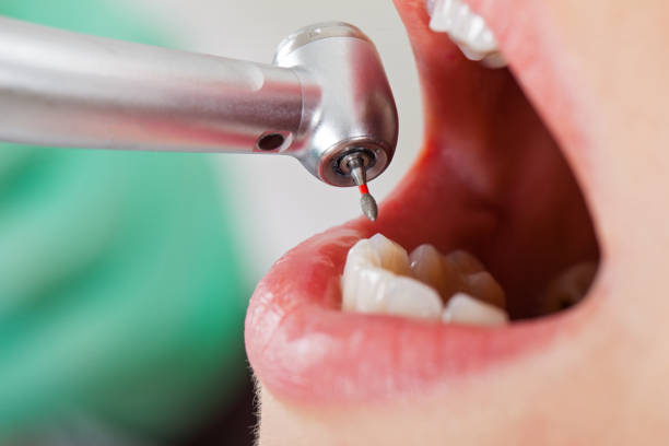 Best Weekend Emergency Dentist in Cedville, AR